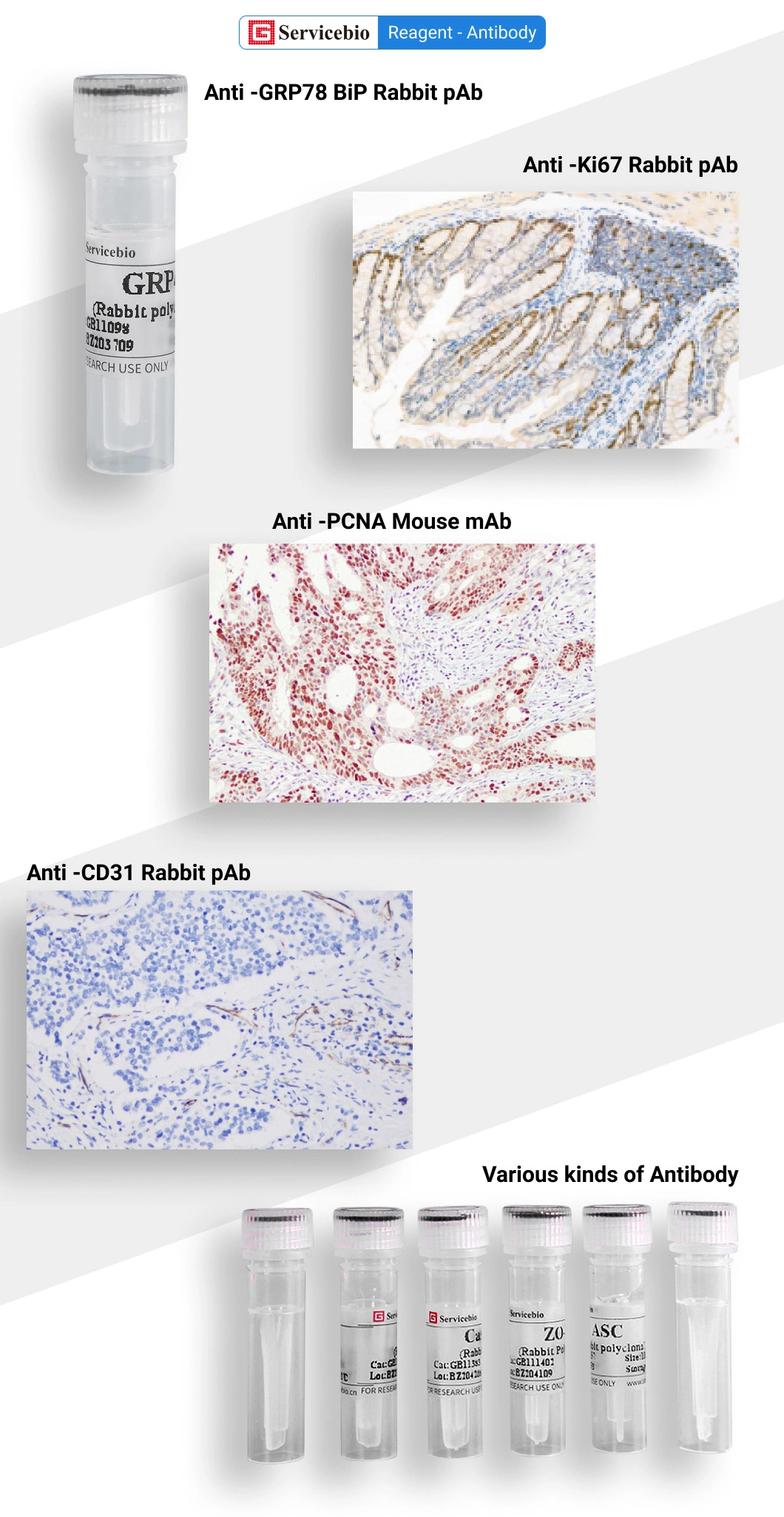 Primary Polyclonal Antibody Anti -Il-1 Beta Rabbit Pab